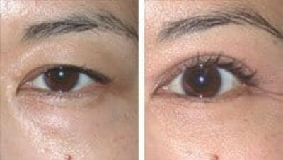 Some Asians Want to Change their Eyes