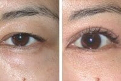 Some Asians Want to Change their Eyes